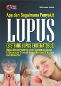 Apa dan Bagaimana Penyakit LUPUS (Sistemik Lupus Eritematosus)
