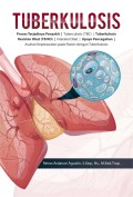 Tuberkulosis